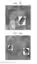 Fig. 05 - Negative active material, lithium battery including the negative active material, and method of preparing the negative active material