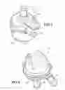 Fig. 05 - Electric fluid pump with improved rotor unit, rotor unit therefor and methods of construction thereof