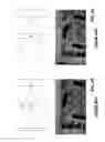 Fig. 04 - Method and system for adjusting camera focus to facilitate infrared imaging
