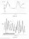 Fig. 10 - Methods and apparatus for improving signal quality in wearable biometric monitoring devices