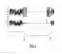 Fig. 04 - MICROPHONE COMPRISING A MUTING SWITCH AND RESPIRATION MASK COMPRISING SUCH A MICROPHONE