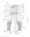 Fig. 05 - POSITIONED HEARING SYSTEM