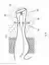 Fig. 07 - POSITIONED HEARING SYSTEM