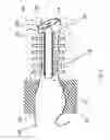 Fig. 09 - POSITIONED HEARING SYSTEM