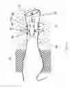 Fig. 10 - POSITIONED HEARING SYSTEM