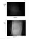 Fig. 10 - Systems and methods for using light energy to facilitate penetration of substances in plants
