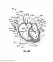 Fig. 63 - Systems and methods for ex-vivo organ care