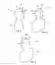 Fig. 05 - HOODED GARMENT