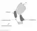 Fig. 01 - KNEE PROTECTION SYSTEM