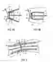 Fig. 05 - HEATED GLOVE AND METHOD OF MANUFACTURING