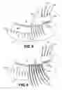 Fig. 06 - Single section lift-up technique for eyelash extensions