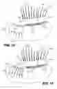 Fig. 07 - Single section lift-up technique for eyelash extensions