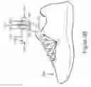 Fig. 06 - KNOT RETAINER