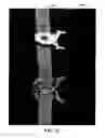 Fig. 26 - Clasp