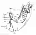Fig. 01 - Carrying Sling for a Child
