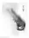 Fig. 16 - Bronchoscopic sheath for measuring or spacing