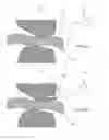Fig. 08 - CANNULOTOME
