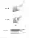 Fig. 15 - CANNULOTOME