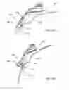 Fig. 28 - CANNULOTOME