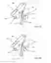 Fig. 30 - CANNULOTOME