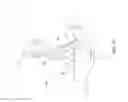 Fig. 10 - Laryngoscope