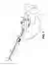 Fig. 02 - ATTACHMENT DEVICE FOR A URETEROSCOPE