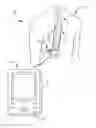 Fig. 01 - Automated calibration of posture state classification for a medical device