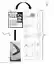 Fig. 02 - GRAPHICAL TECHNIQUE FOR DETECTING CONGESTIVE HEART FAILURE