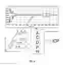 Fig. 06 - Method for measuring intracranial elasticity