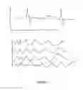 Fig. 08 - Method for measuring intracranial elasticity