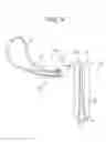 Fig. 09 - Suture leader