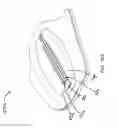 Fig. 76 - Rapid closing surgical closure device