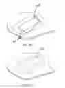 Fig. 77 - Rapid closing surgical closure device