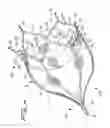 Fig. 03 - DEVICE FOR PREVENTING CLOT MIGRATON FROM LEFT ATRIAL APPENDAGE