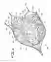 Fig. 05 - DEVICE FOR PREVENTING CLOT MIGRATON FROM LEFT ATRIAL APPENDAGE