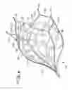 Fig. 06 - DEVICE FOR PREVENTING CLOT MIGRATON FROM LEFT ATRIAL APPENDAGE