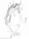 Fig. 04 - Compression device and pressure sensor for treatment of abnormal upper esophageal sphincter functionality