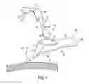 Fig. 02 - Methods and devices for forming holes in bone to stimulate bone growth