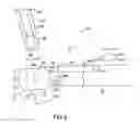 Fig. 09 - Methods and devices for forming holes in bone to stimulate bone growth