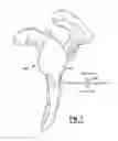 Fig. 02 - System and method for assisting with arrangement of a stock instrument with respect to a patient tissue
