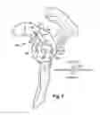 Fig. 06 - System and method for assisting with arrangement of a stock instrument with respect to a patient tissue