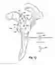 Fig. 10 - System and method for assisting with arrangement of a stock instrument with respect to a patient tissue