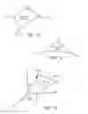 Fig. 11 - Tibial arthroplasty jig