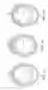 Fig. 07 - Rotational atherectomy device