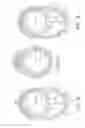 Fig. 08 - Rotational atherectomy device