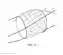 Fig. 06 - Expandable balloon