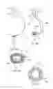 Fig. 25 - Surgical access assembly and method of using same