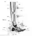 Fig. 32 - Clamping device for use with an anatomic external fixation system