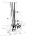 Fig. 33 - Clamping device for use with an anatomic external fixation system
