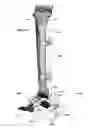 Fig. 41 - Clamping device for use with an anatomic external fixation system